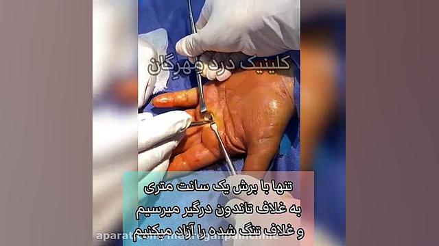 انگشت ماشه ای . کلینیک درد مهرگان رفع افتادگی پلک