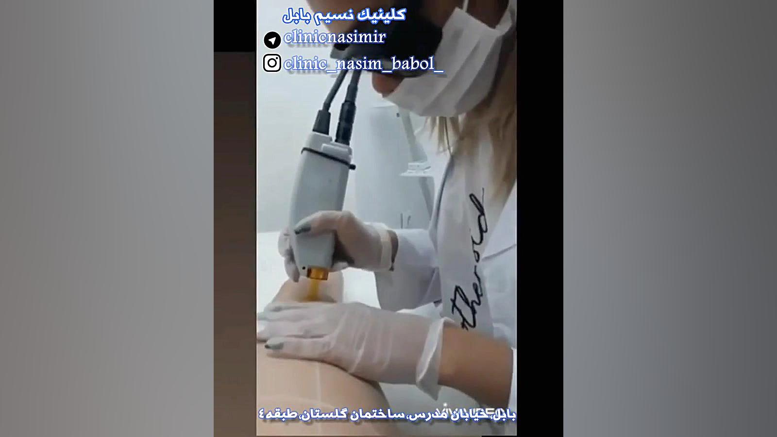 کلینیک لیزر بابل دستگاه فیبر نوری جراحی
