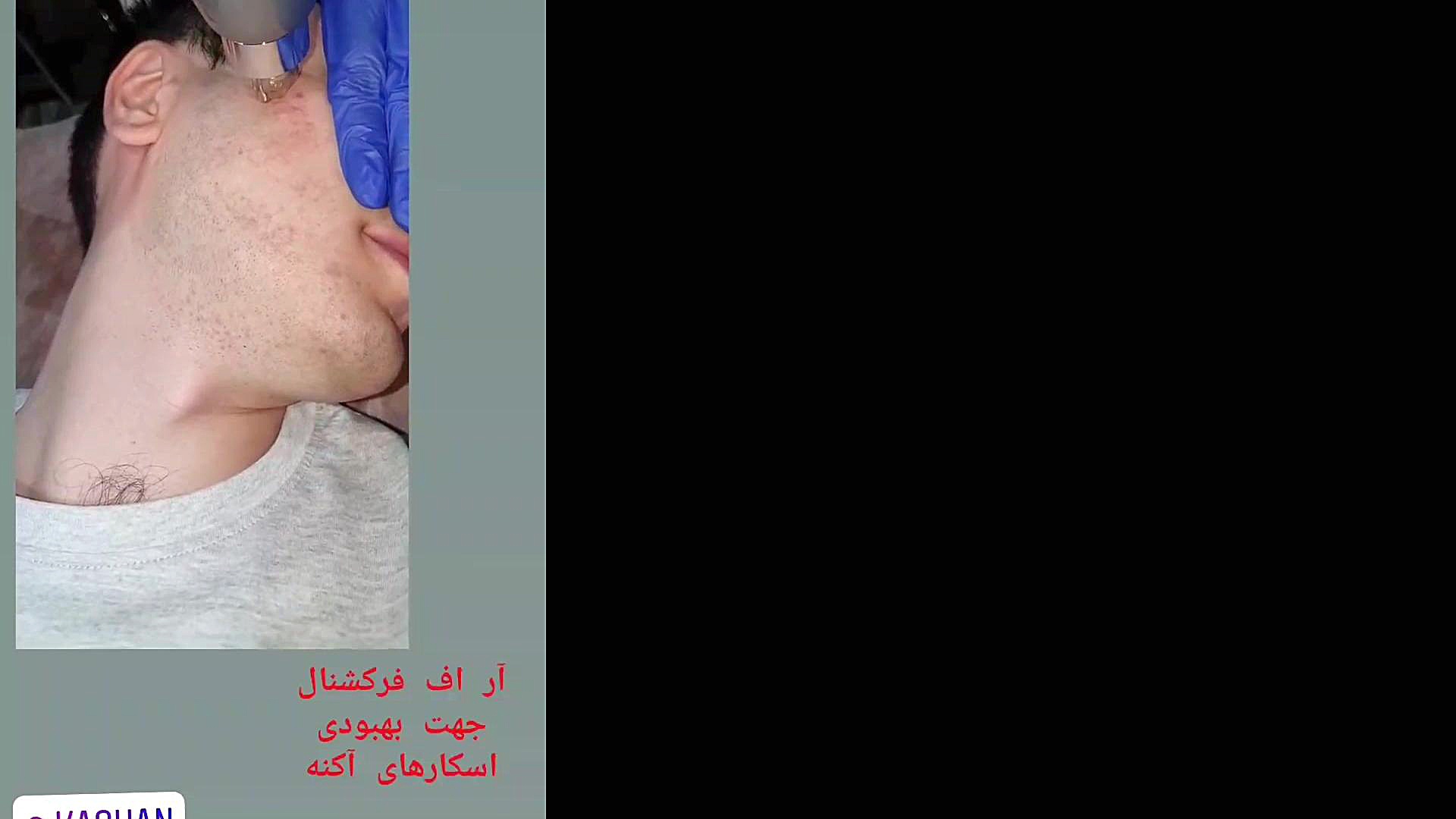 آر اف فرکشنال کاشان پزشکی شخصی‌سازی‌شده سطح یاخته‌ای