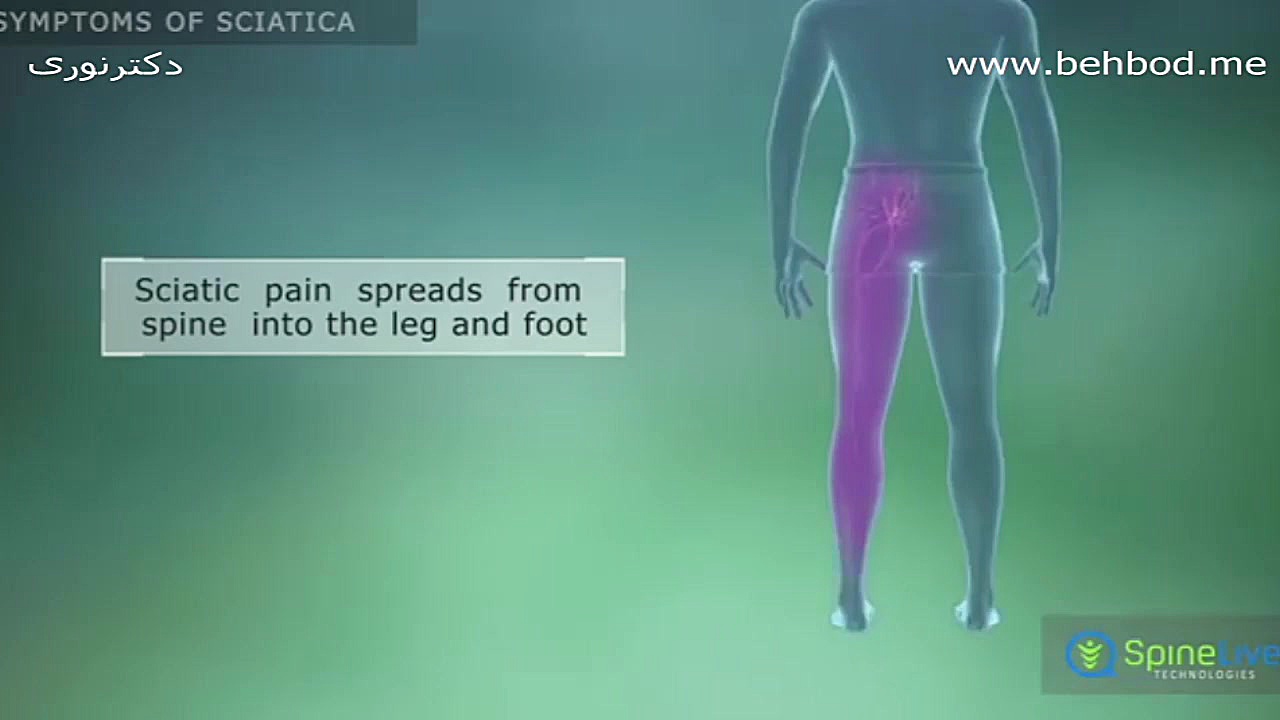 سیاتیک دکتراسماعیل نوری