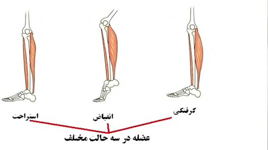 دلیل گرفتگی عضلات دلیل گرفتگی عضلات