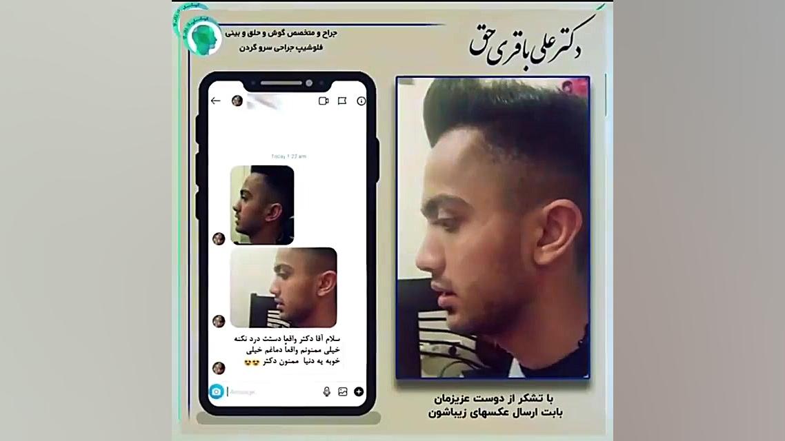 رضایت بیماران دکتر باقری حق پس از عمل زیبایی بینی دکتر علی باقری حق