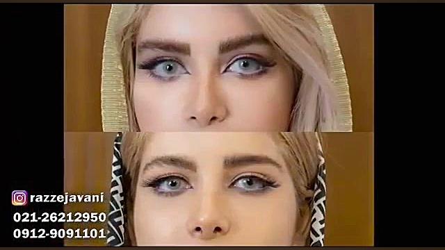 لیفت ابرو فرمانزوماب