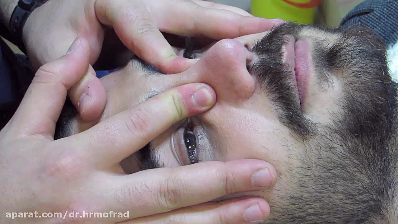 نحوه ماساژ بینی ( دکتر مفرد ) دکتر حمیدرضا مفرد