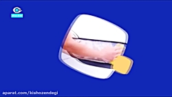 کیش و زندگی - ترفند