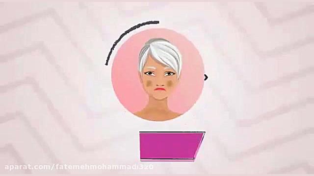 گوینده: فاطمه محمدی |موشن گرافیک درمان لک صورت یک دغدغه ی مهم برایهمه کشیدن دندان