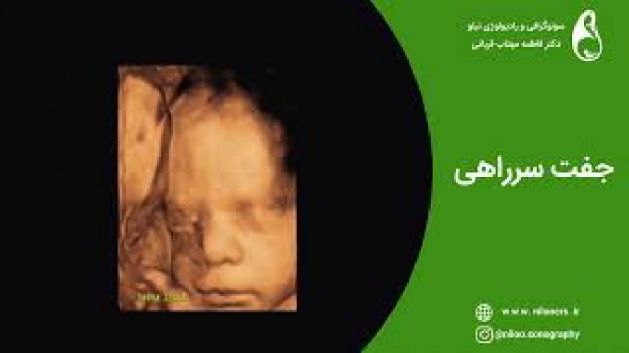 جفت سرراهی سونوگرافی نیلو دکتر فاطمه مهتاب قربانی