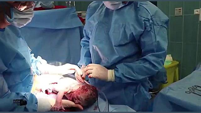 فیلم به دنیا آمدن نوزاد توسط دکتر ناصحی زمان93ثانیه