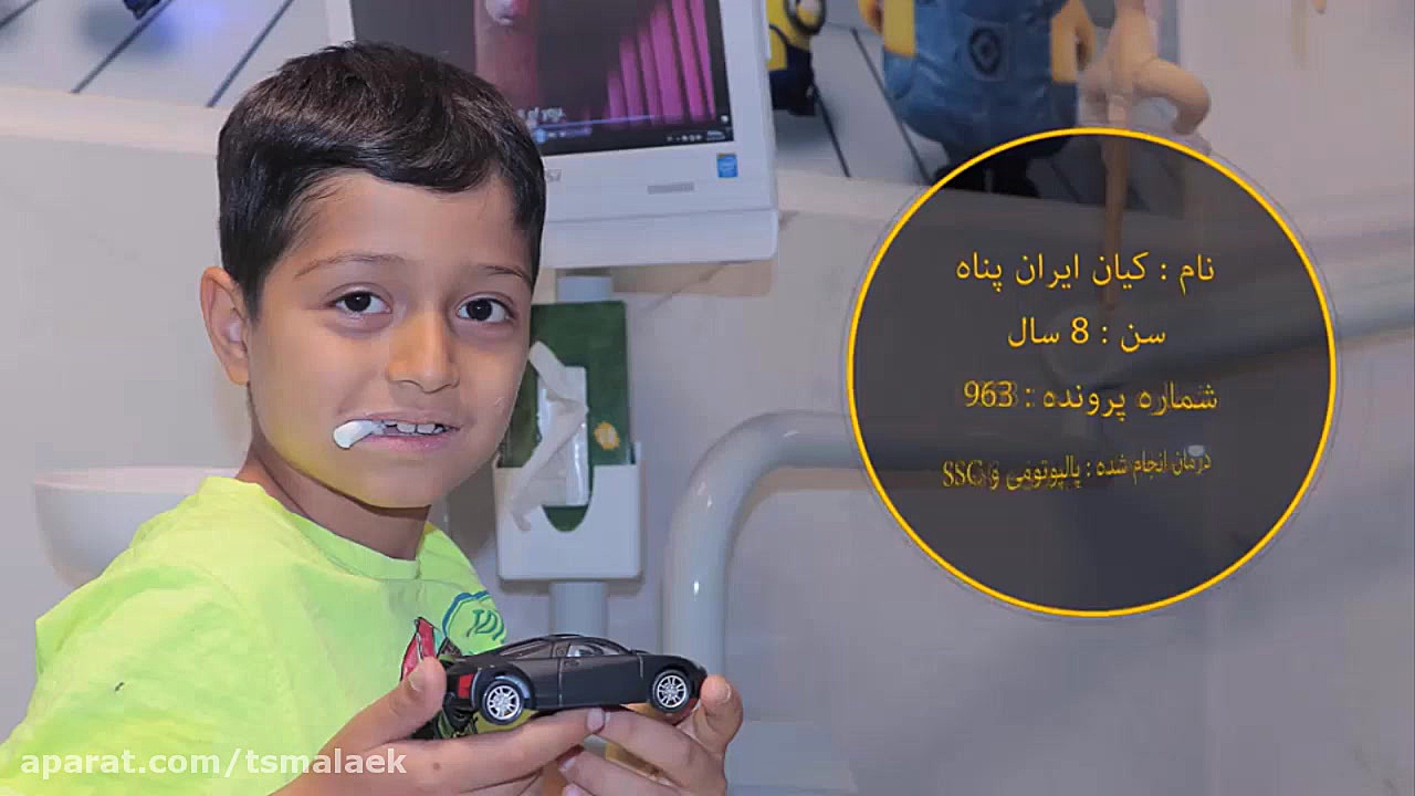 پالپوتومی و ssc آزمایش شمارش رتیکولوسیت