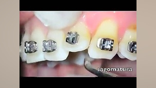 جرمگیری و ارتودنسی دکتر سهیل سالاری