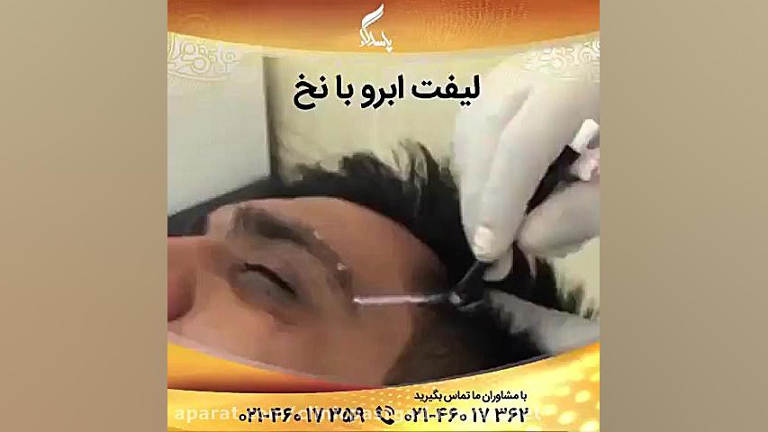 لیفت ابرو با نخ کلونیک اسپاسم