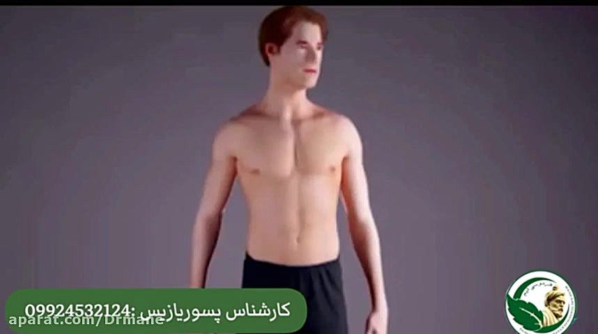 درمان قطعی بیماری پوستی صدفک لیلا بلوکات