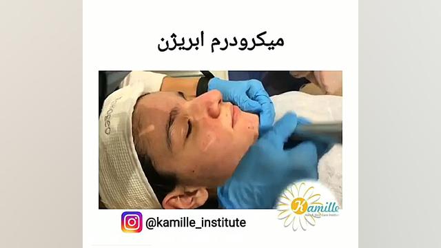 برترین ها - مرکز پوست مو و لیزر کامیله بیماری سندروم نوتان