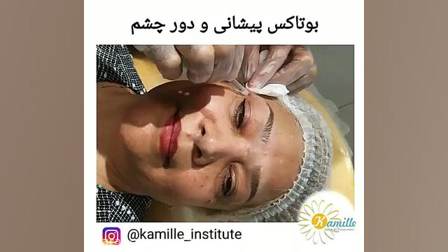 برترین ها - مرکز پوست مو و لیزر کامیله پزشکی فضاپویا