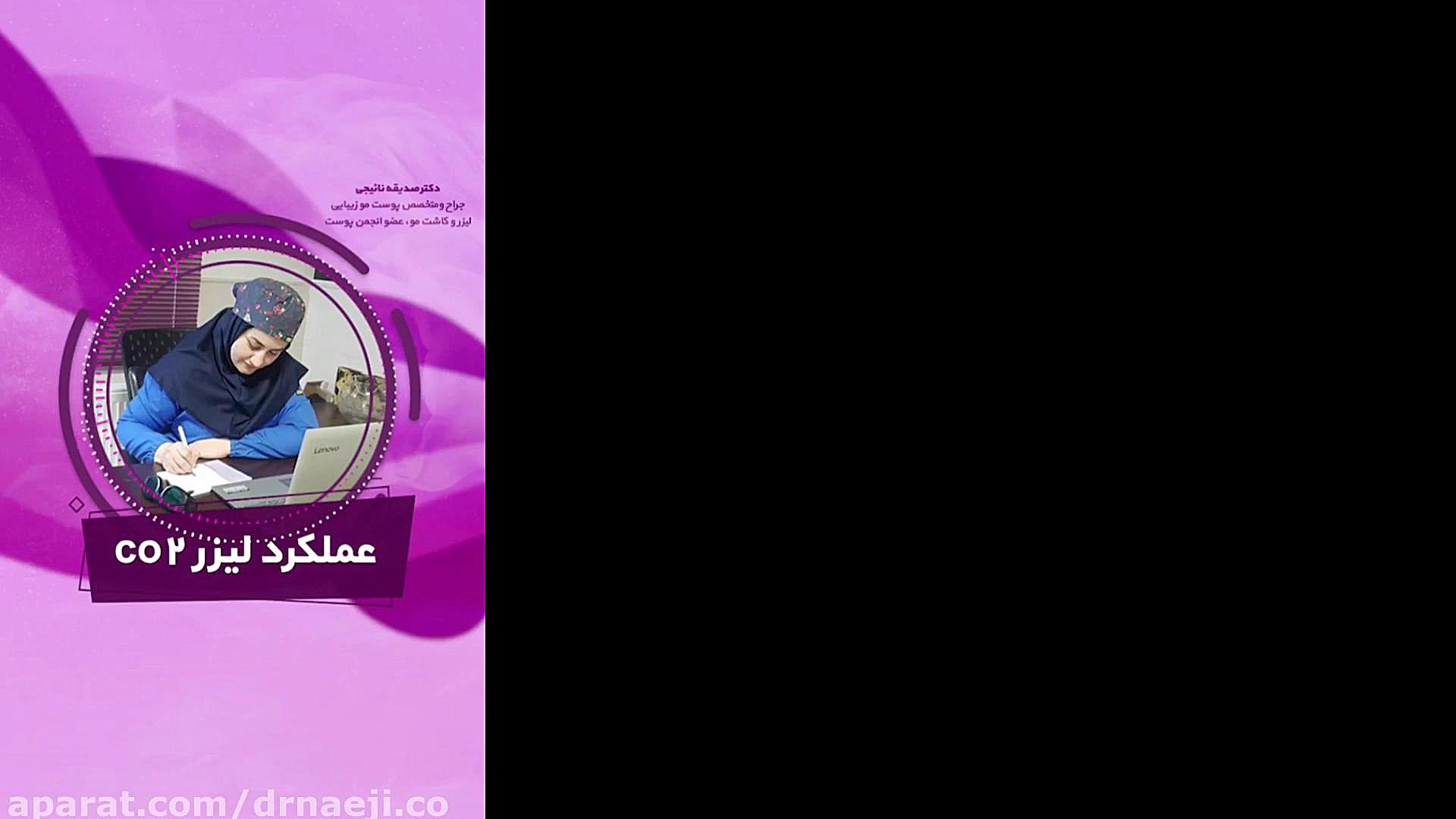 فیلم لیزر CO2 دکتر صدیقه نائیجی | متخصص پوست و مو در قم