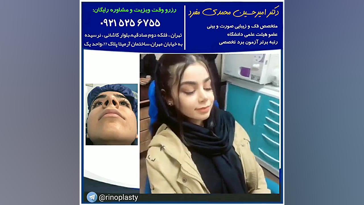 عمل زیبایی بینی دکتر محمدی مفرد(09215256755) دکتر امیر حسین محمدی مفرد