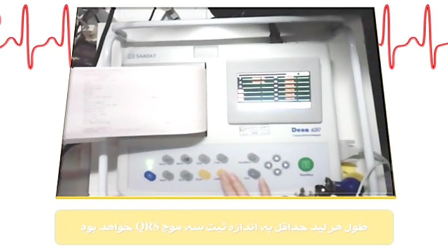 تنظیمات دستگاه ECG (نوار قلب) پوسیدگی دندان