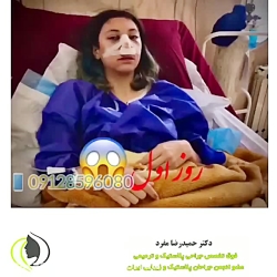 روند بهبودی بعد از عمل زیبایی