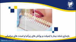بازسازی لبخند بیمار با ایمپلنت و روکشهای زیرکنیا و لمینیتهای سرامیکی کلینیک دندانپزشکی دکتر عزیز گشاده رو