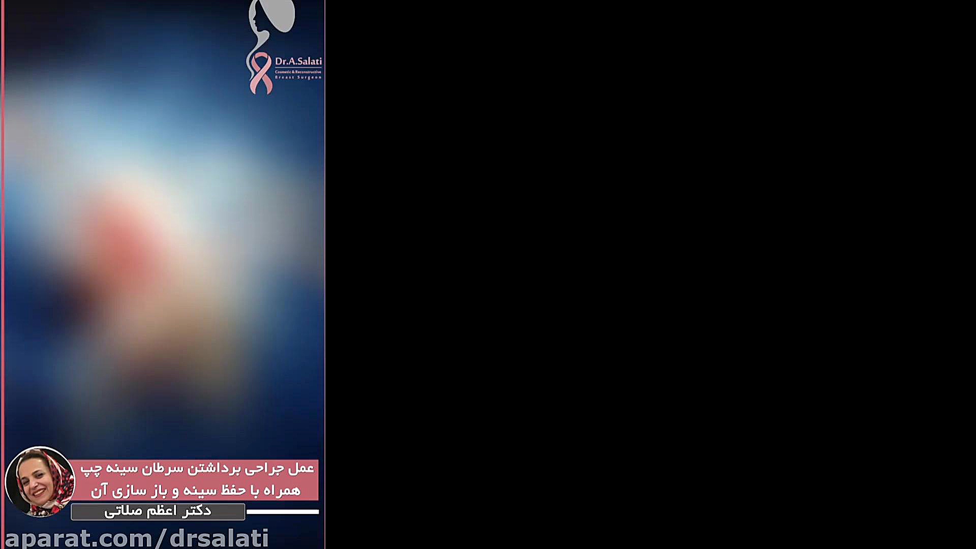 فیلم عمل جراحی سرطان سینه چپ تزریق ژل