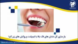 بازسازی کل دندانهای فک بالا با ایمپلنت و روکشهای زیرکنیا کلینیک دندانپزشکی دکتر عزیز گشاده رو