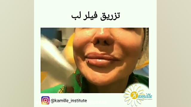 برترین ها - مرکز پوست مو و لیزر کامیله کلینیک دندانپزشکیایمونولوژی پیوند