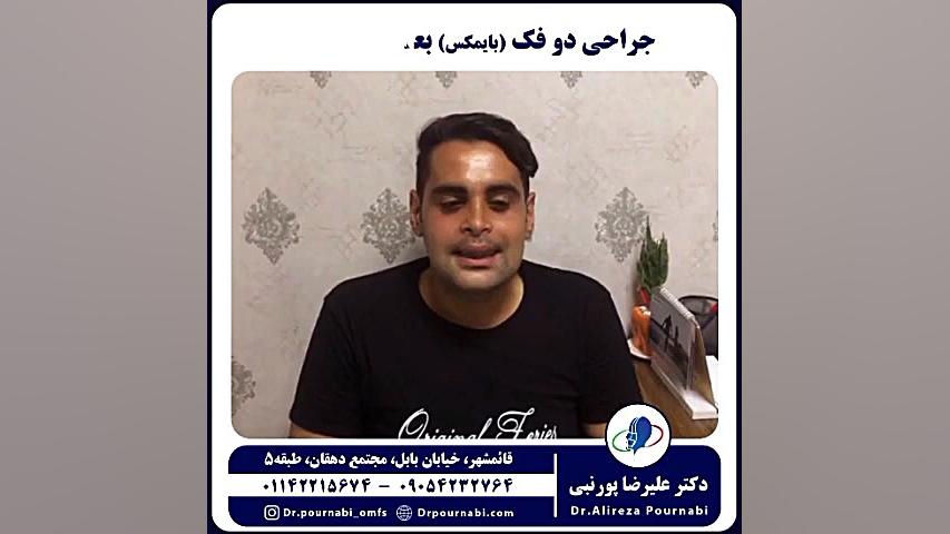 جراحی فک (بایمکس) Single Molecule Real Time Sequencing