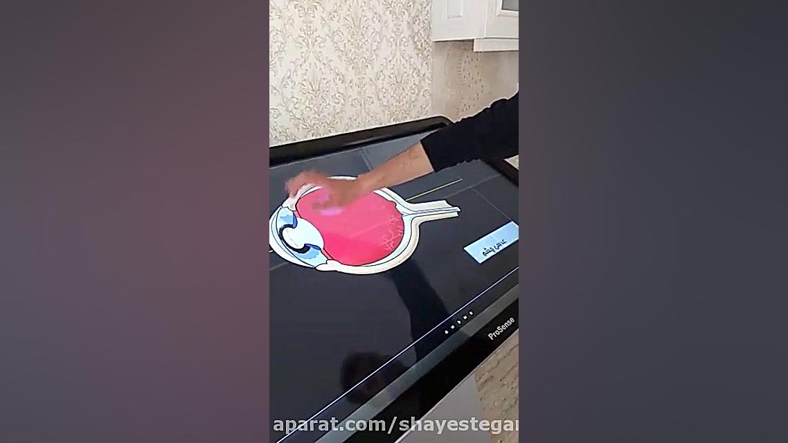 نمایش بینایی چشم با برد فوق هوشمند لیپوست