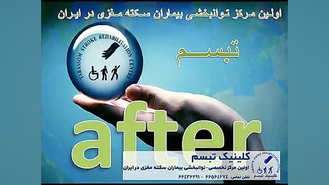 تزریق دیسپورت - درمان سکته مغزی - کلینیک تبسم تزریق بوتاکس