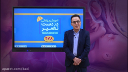 درس زنان (مبحث PROM)