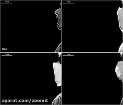 کدام نوع ماسک عملکرد بهتری در...