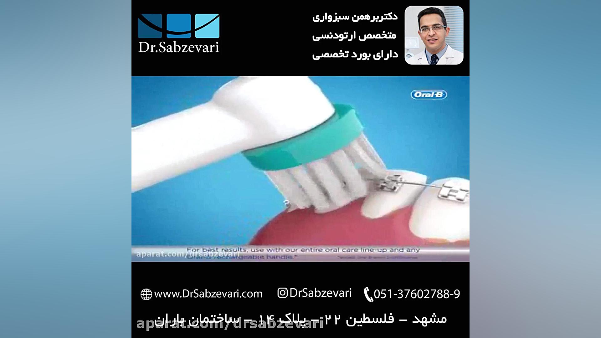 مسواک برقی در ارتودنسی ثابت - بخش اول دکتر برهمن سبزواری - متخصص ارتودنسی - مشهد
