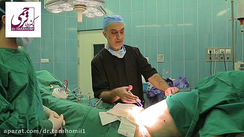 فیلم عمل پیکرتراشی پادکست لبو