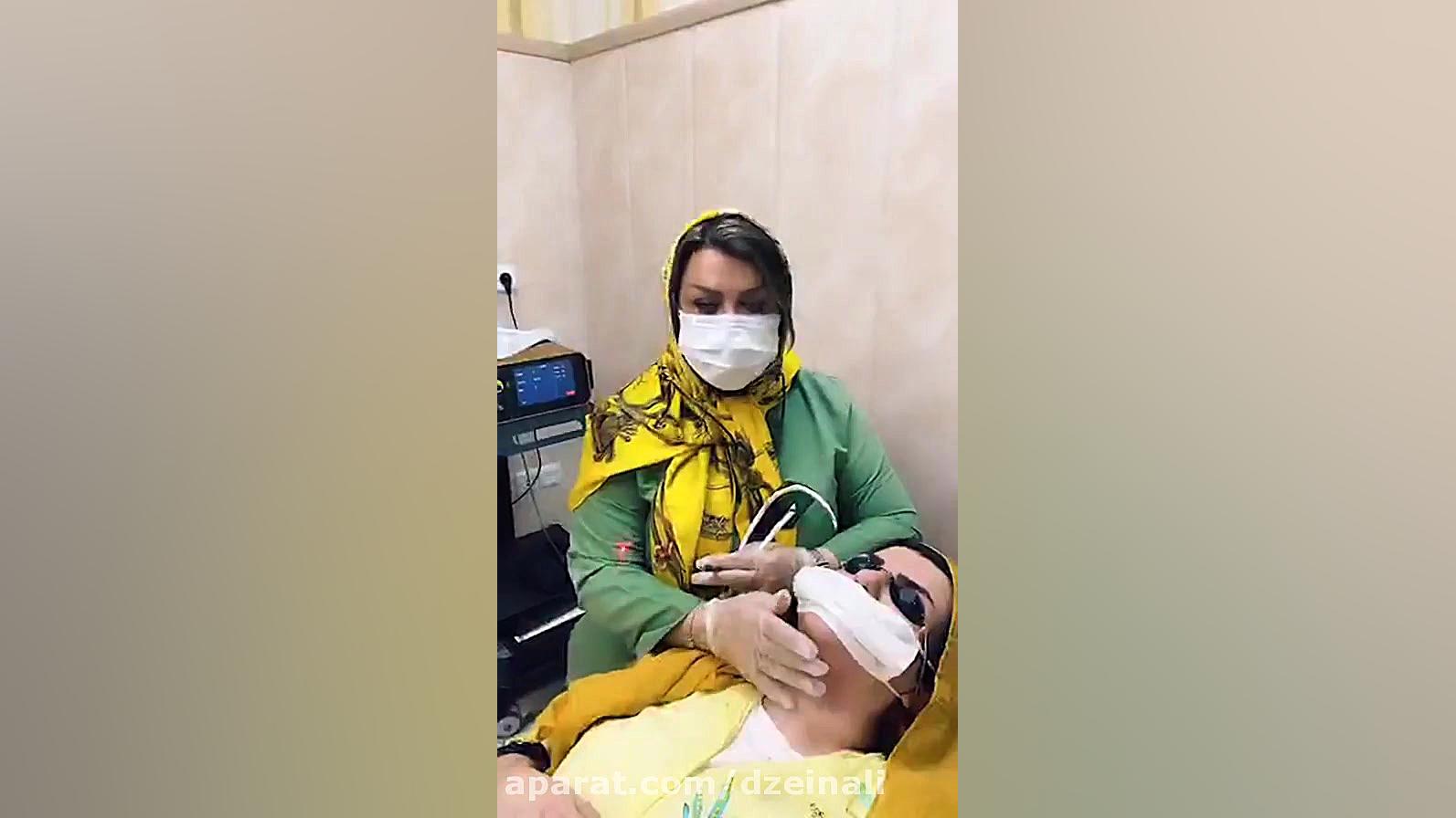 اندولیفت لیزر برای رفع دايمی غبغب دکتر فرحناز زینعلی - متخصص پوست، مو، زیبایی زنجان