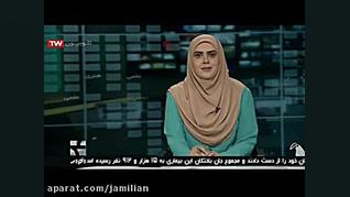 اصلاح و درمان ناهنجاریهای فک در کودکان با اختراع متخصص ارتودنسی ایرانی دکتر عبدالرضا جمیلیان - متخصص ارتودنسی