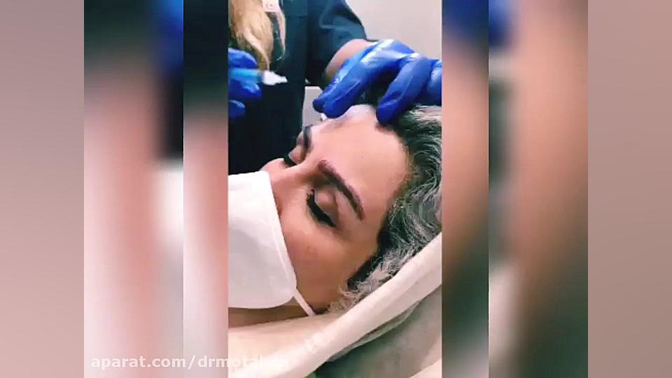 فیلم کربوکسی تراپی ابرو Screening Lentiviral Vector