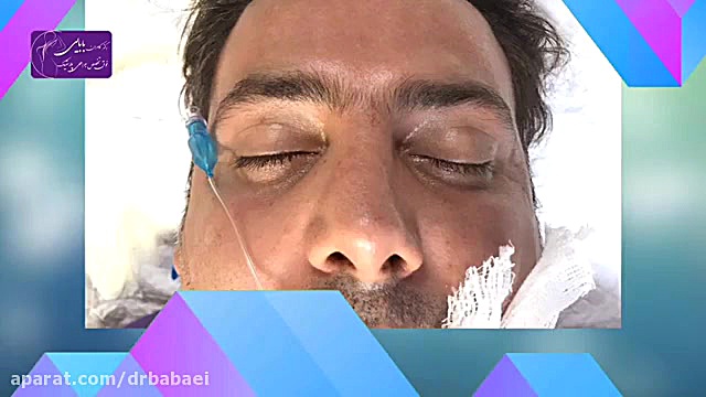 فیلم واقعی عمل بینی مردانه طبیعی دکتر کامران بابایی