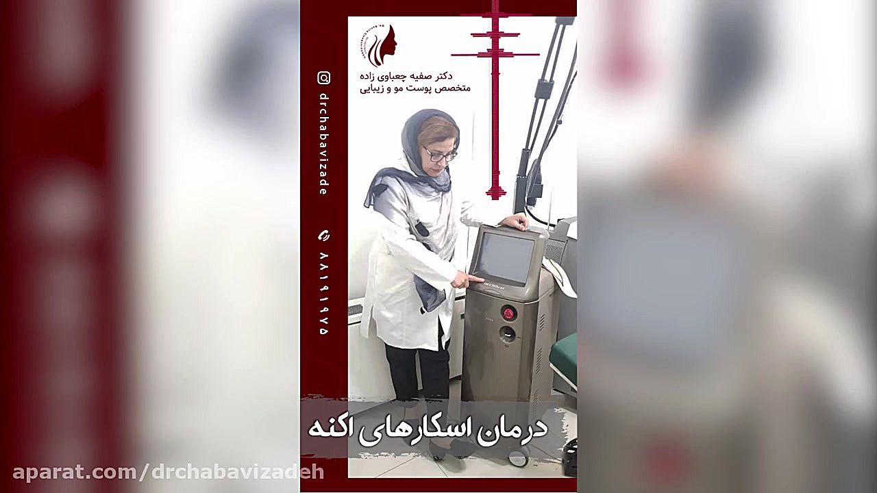 فیلم توضیحات دکتر چعباوی زاده درمورد نحوه درمان اسکار های آکنه دکتر صفیه چعباوی زاده