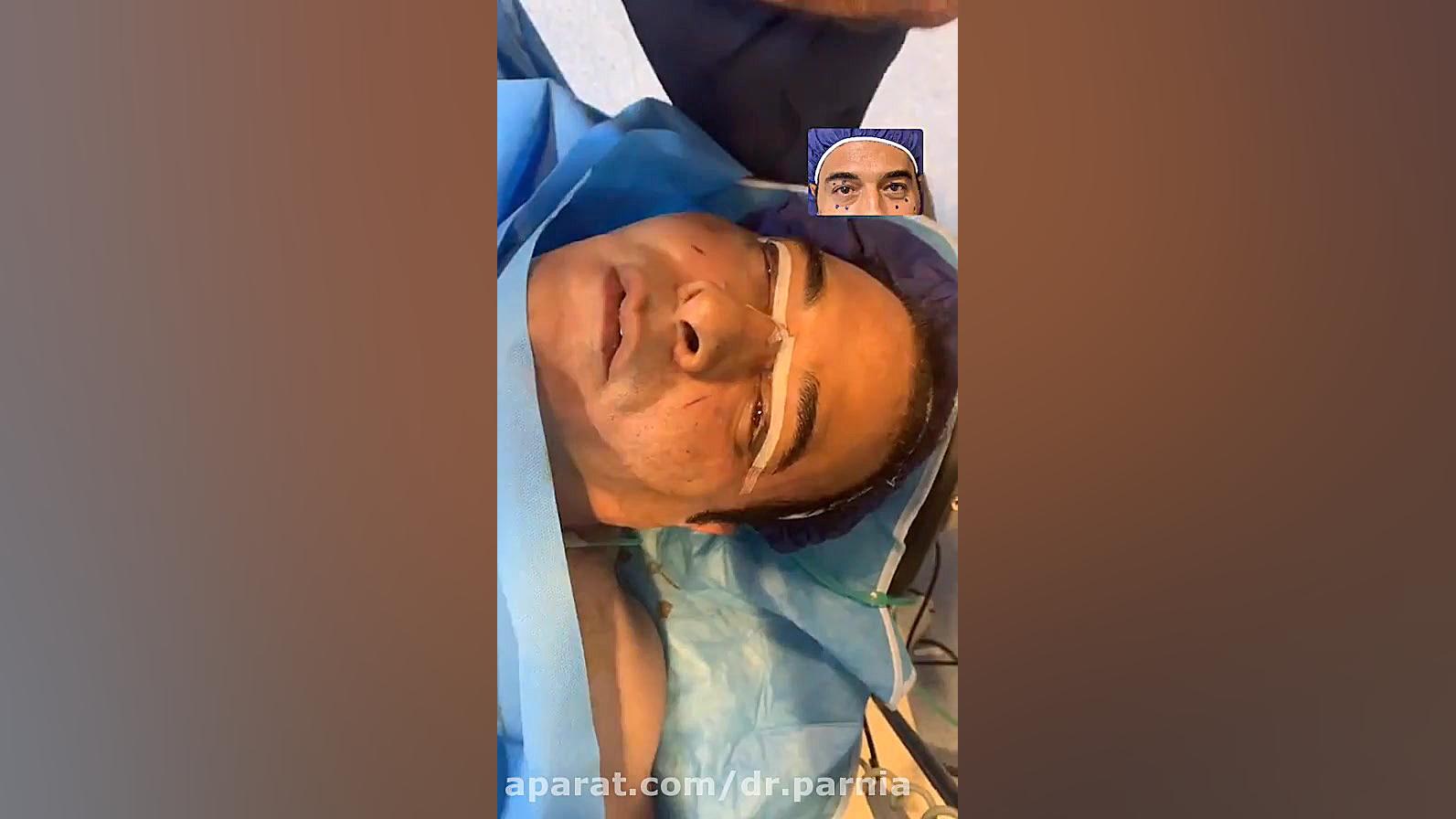 فیلم عمل همزمان بلفاروپلاستی و لیپوماتیک شکم و پهلو انسریدا