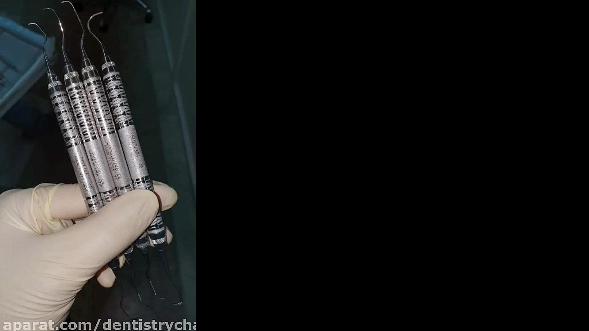 اسکلینگ و روت پلنینگ دستی ( دکتر زارعی ) کلونینگ درمانی