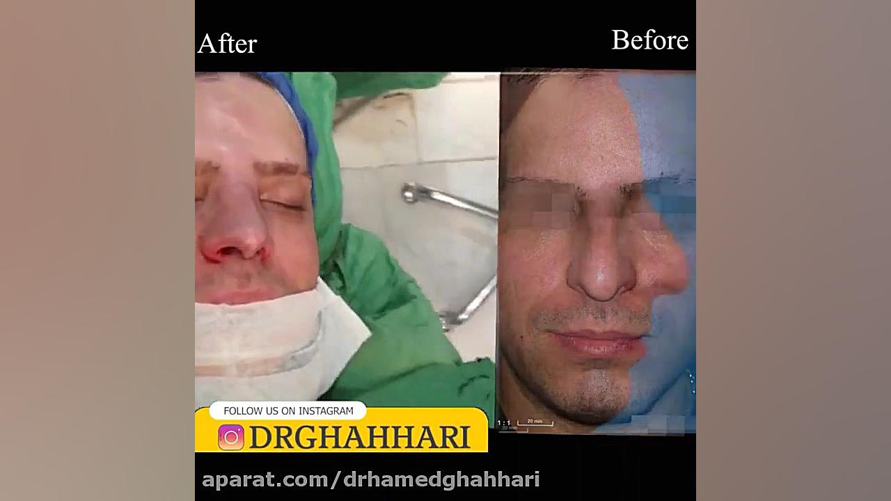 فیلم وحشتناک عمل بینی دکتر حامد محمدی قهاری