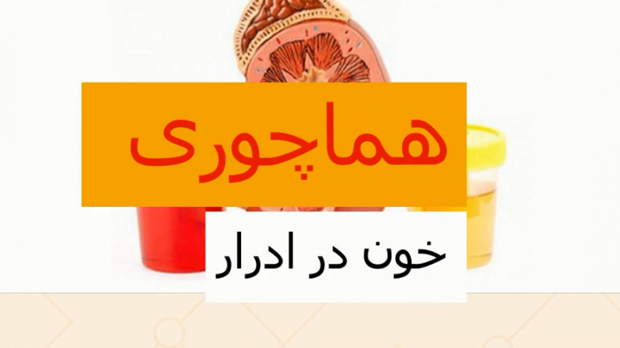 هماچوری یا خون در ادرار ـ دکتر میر صادقی لیپوماتیک