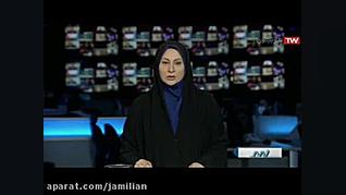 درمان ناهنجاری فک با اختراع دستگاه کوچک در دهان / متخصص ارتودنسی دکتر عبدالرضا جمیلیان - متخصص ارتودنسی