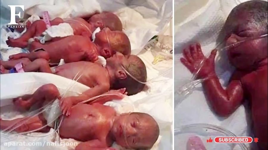 مادری که در 9 دقیقه 6قلو زایید !