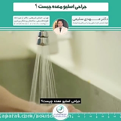 جراحی اسلیو معده چیست؟