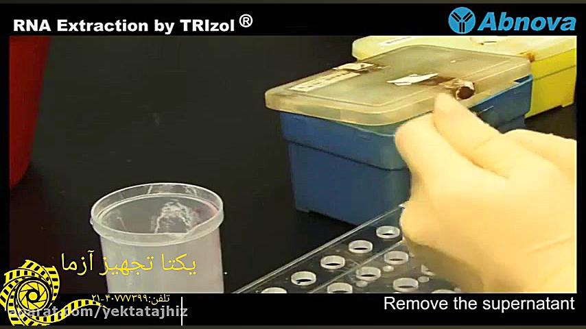 استخراج RNA با محلول ترایزول بلیچینگ
