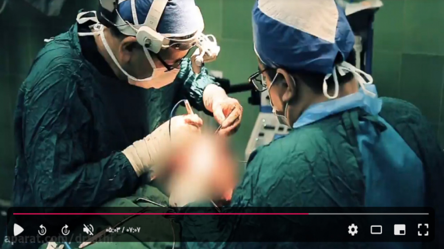 فیلم عمل بازسازی جمجمه دکتر حمید رضا فتحی فوق تخصص جراحی پلاستیک