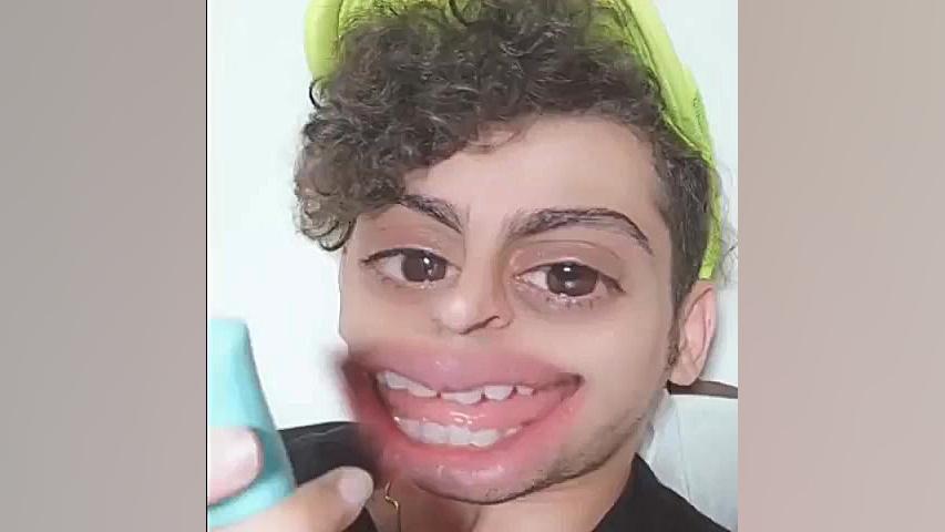 فردین جهانشیری کرونا 2 جراحی زیبایی پلک