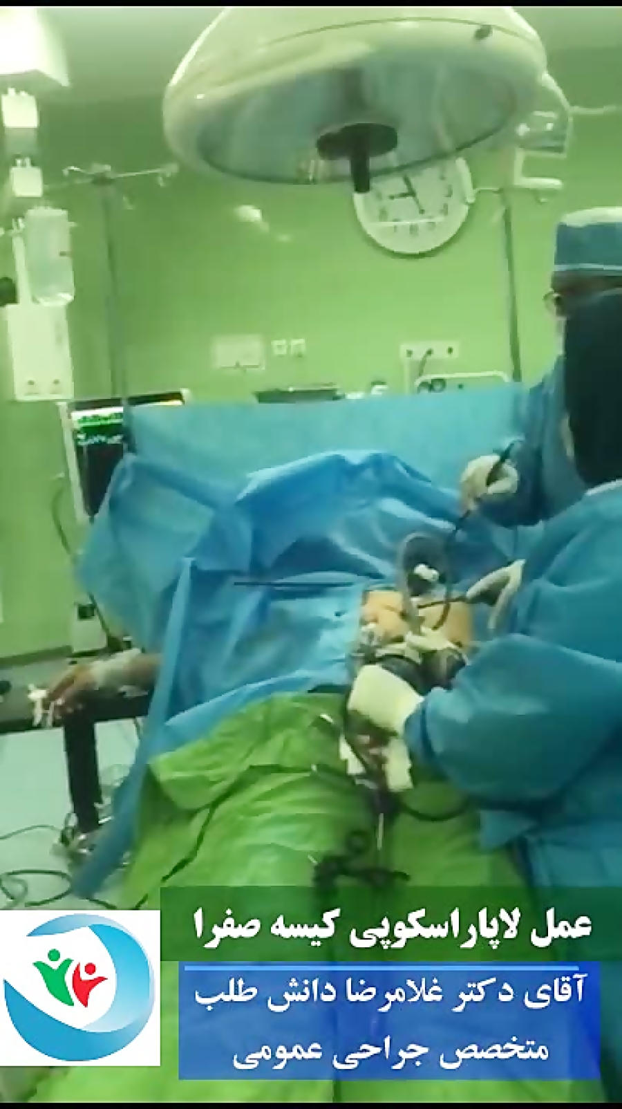عمل لاپاراسکوپی کیسه صفرا