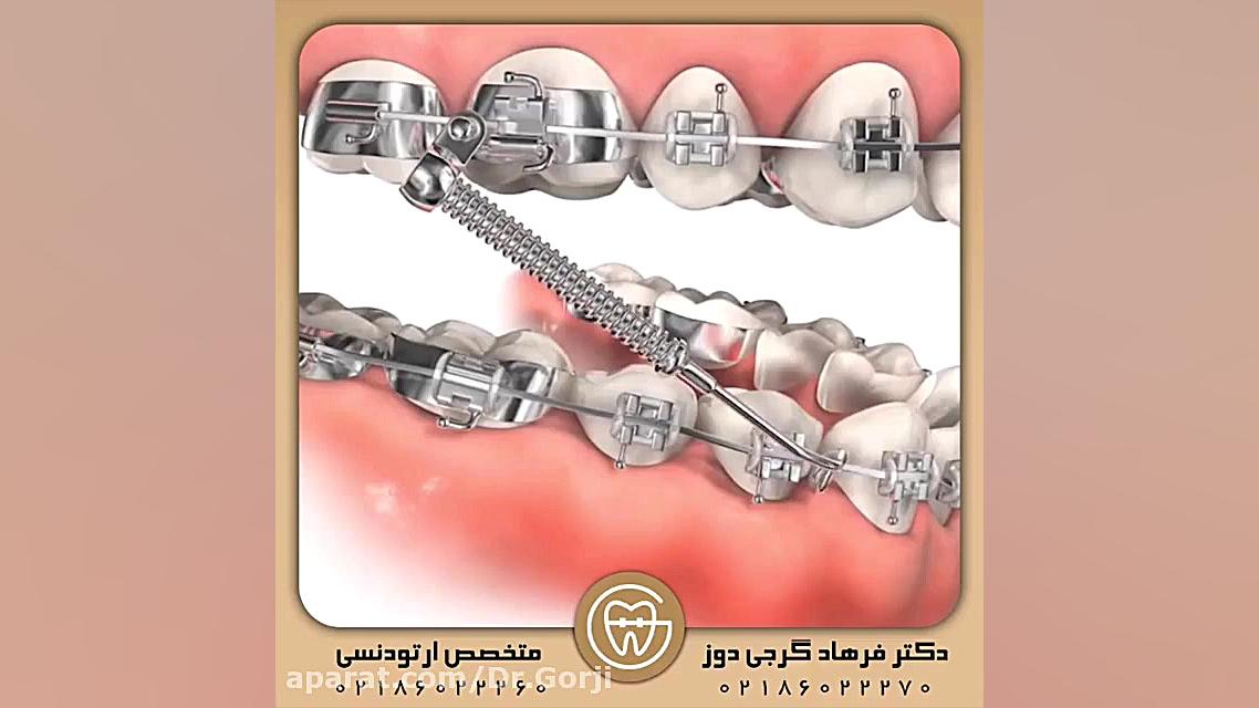 دستگاه فانکشنال ثابت | دکتر فرهاد گرجی دوز پادکست